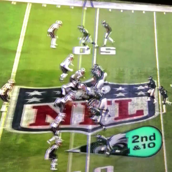 Did Patriots Patrick Chung play with a concussion?