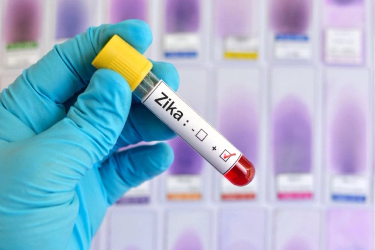 Zika now transmitted by sex