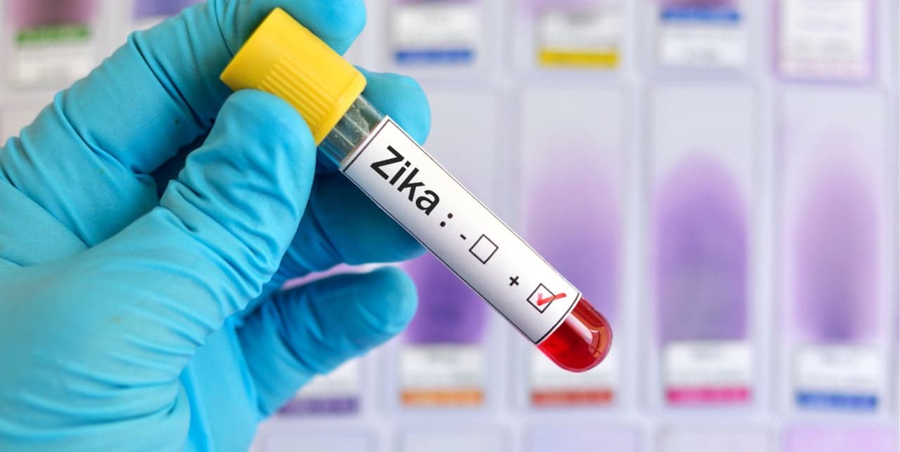 Florida has first case of sexually transmitted Zika virus