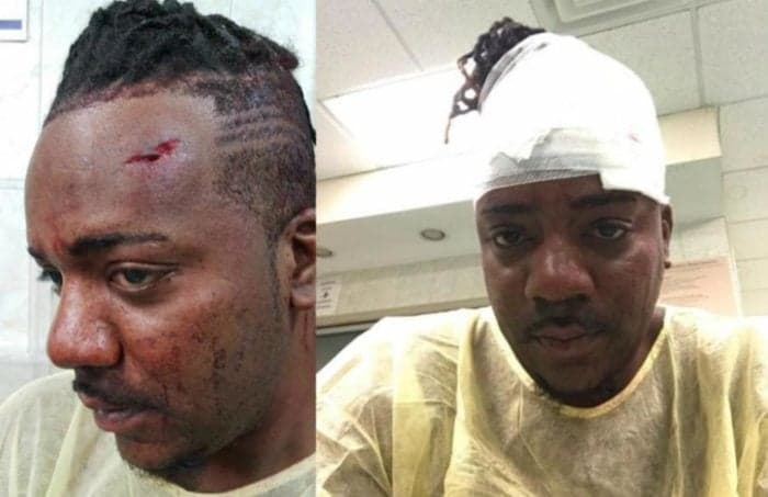 Trial of Bahamian man accused of beating Jamaican gay postponed