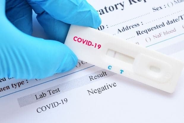 New Cases Push Haiti’s COVID-19 Numbers Past 800