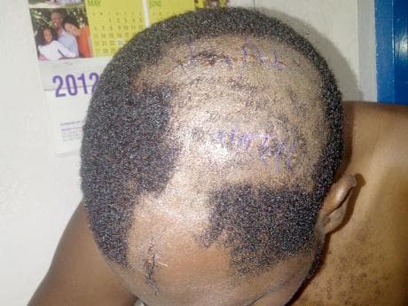 Dudus’ brother, female friend shot at Hellshire Beach