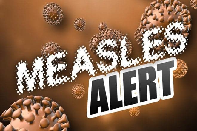 Belize confirms measles case linked to Guatemala travel