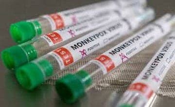 Barbados records first case of Monkeypox virus