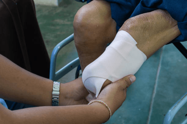 How Surgical Mistakes Can Result in Limb Loss