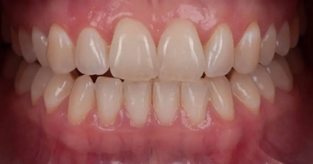 How to protect your teeth from everyday damage