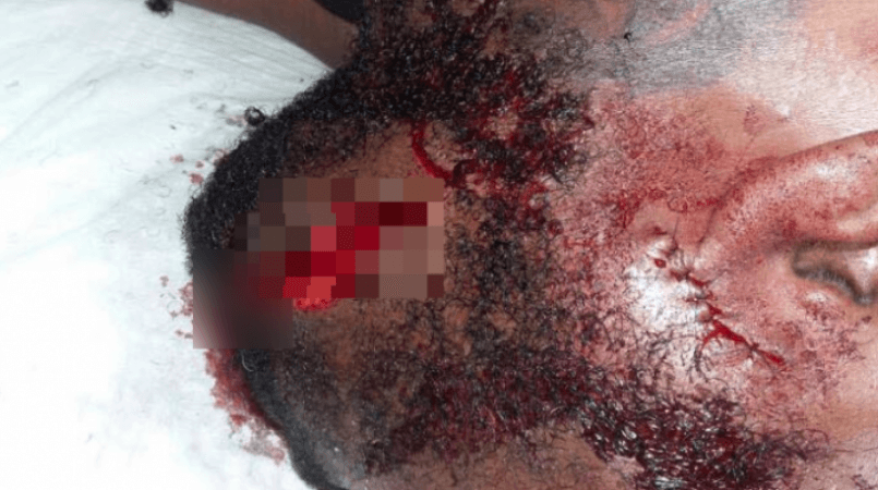 Soca singer Benjai clouted with beer bottle in Guyana
