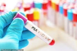 Guyanese Urologist says prostate cancer screening should start at age 40