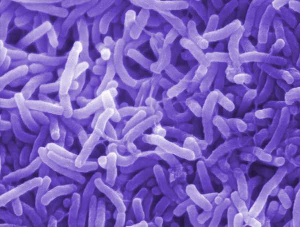 Jamaican health officials monitoring patient with symptoms of cholera