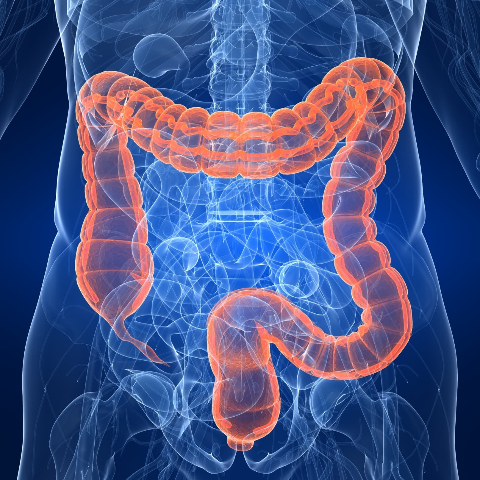 Over 50? check your colon