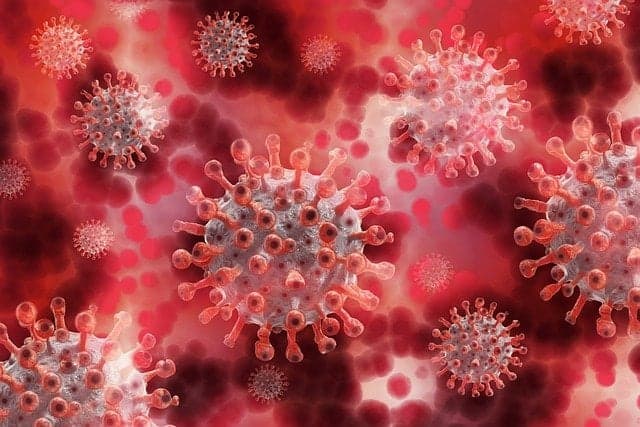 Jamaican Government to Acquire Equipment to Test for COVID Variants