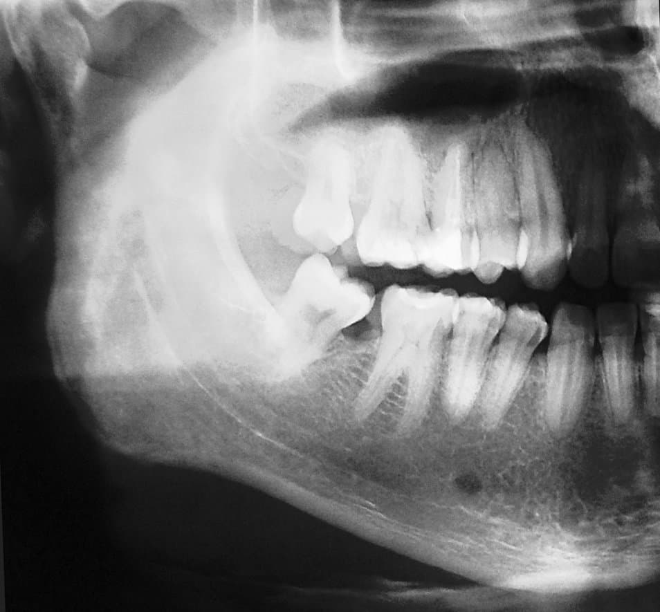 #DentalFeature: All You Need To Know About Dental X-rays