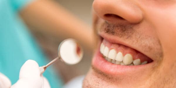 #DentalFeature: Gum Surgery – What Do I Need To Know?