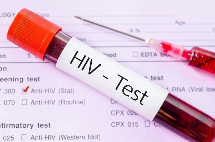 Antigua and Barbuda health official warns of rising HIV cases among youth