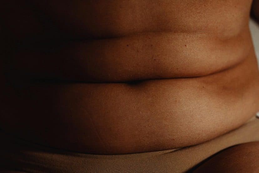 A look at obesity in the Caribbean