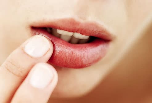#HealthFeature: Cold Sores And Fever Blisters