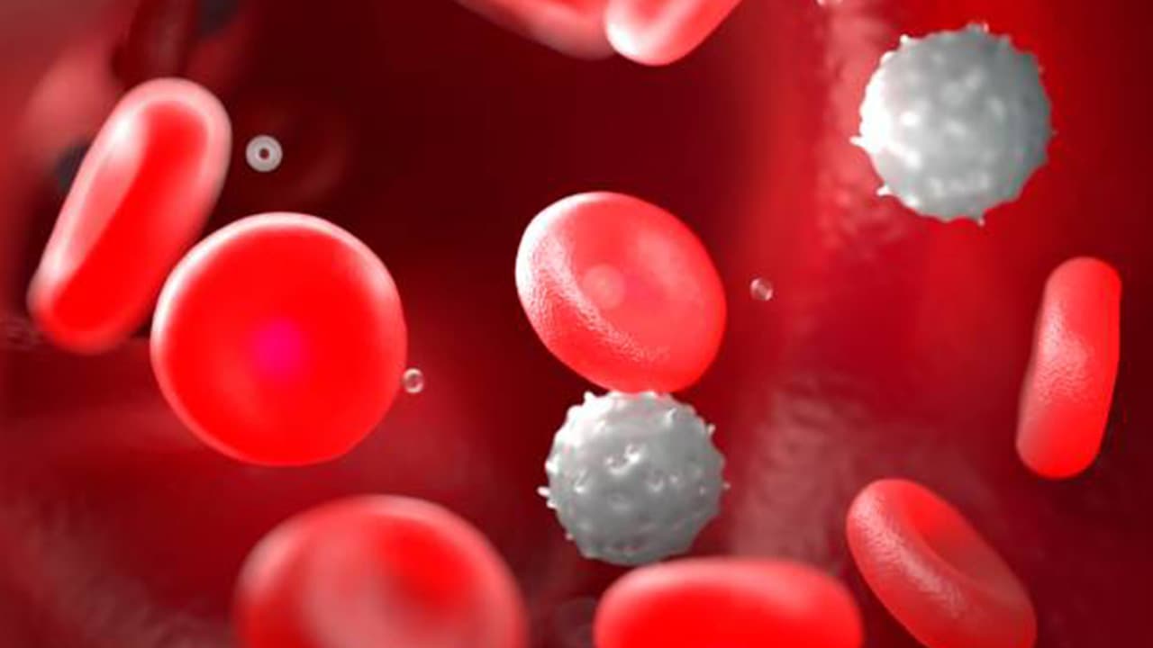 New Project to Detect Sickle Cell in New-Born Babies in OECS