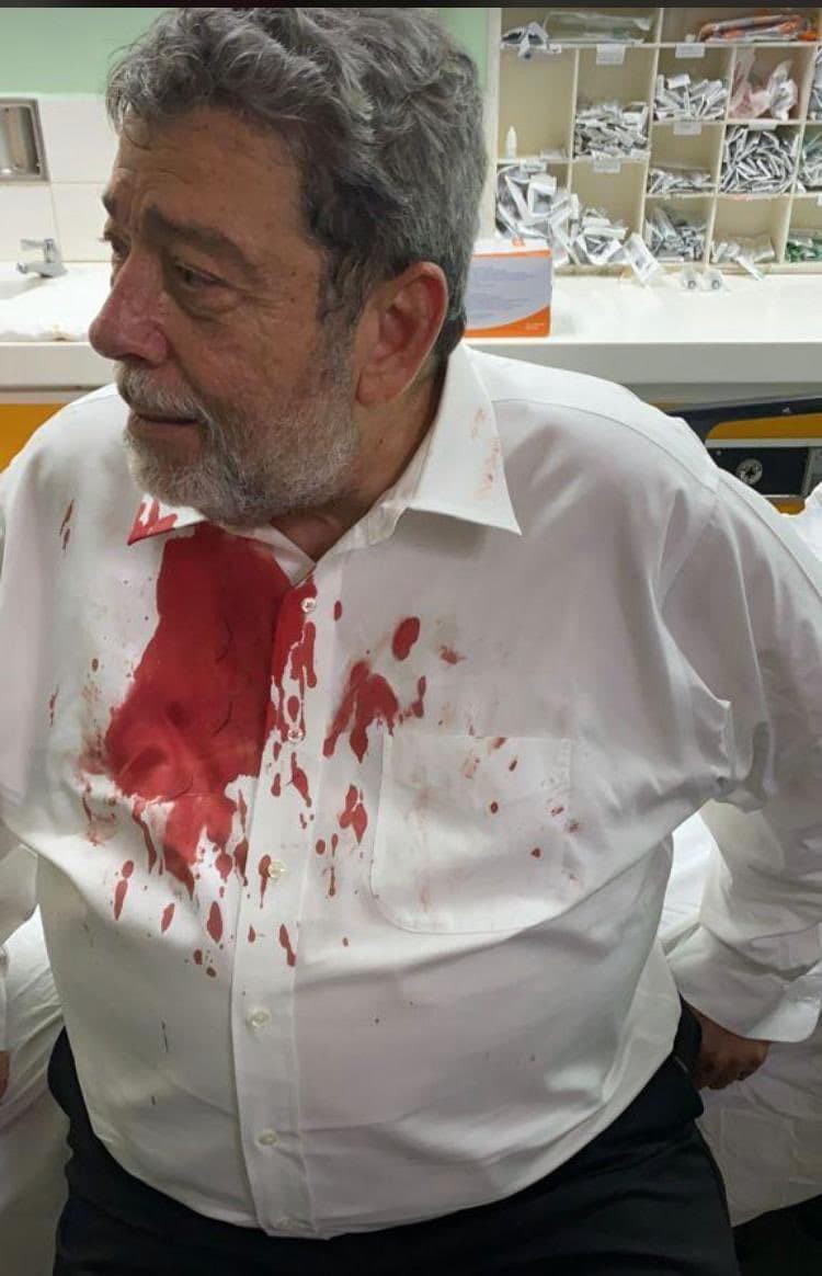 St Vincent PM Suffers Concussion After Attack During Vaccine Protest