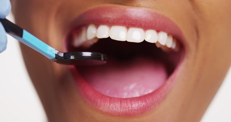 Do You Know What Supports Your Teeth?