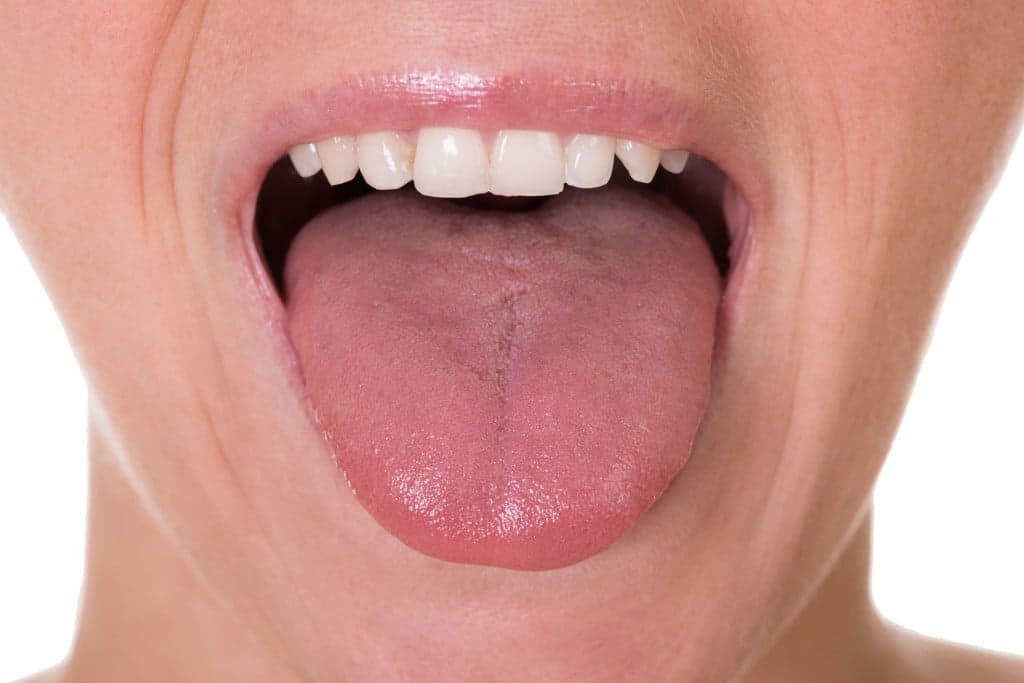 #DentalFeature: What Causes A Swollen Tongue?