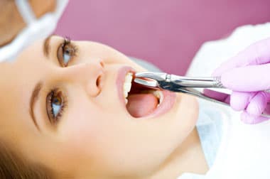 Multiple Teeth Extractions: Is it Safe? (For dentures)