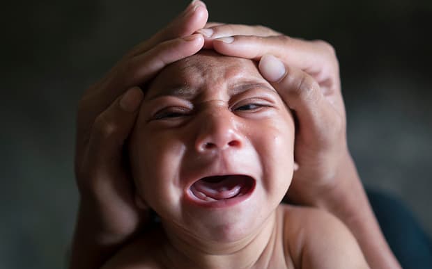 1 in 10 U.S. pregnant women with Zika had fetus/baby with birth defects