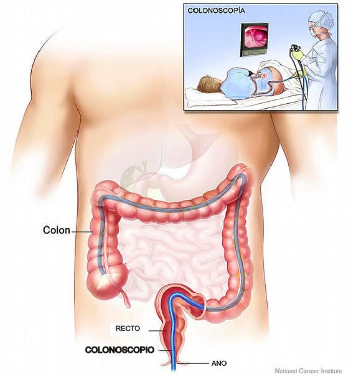 No need to be fearful of a COLONOSCOPY