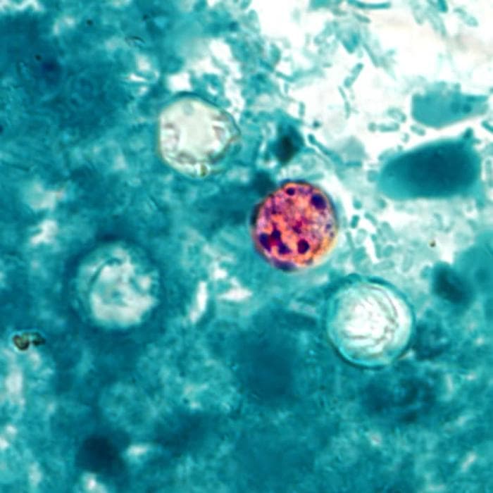 Cayman Islands confirms imported cyclosporiasis case amid U.S. outbreak investigation