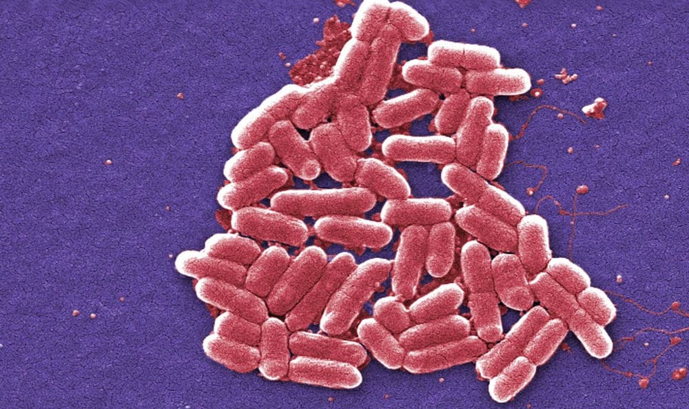 CDC announces multi-state outbreak of E. coli virus