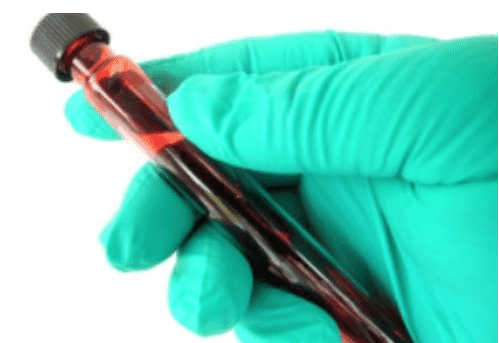 Barbados sends 27 blood samples to be tested for Zika virus