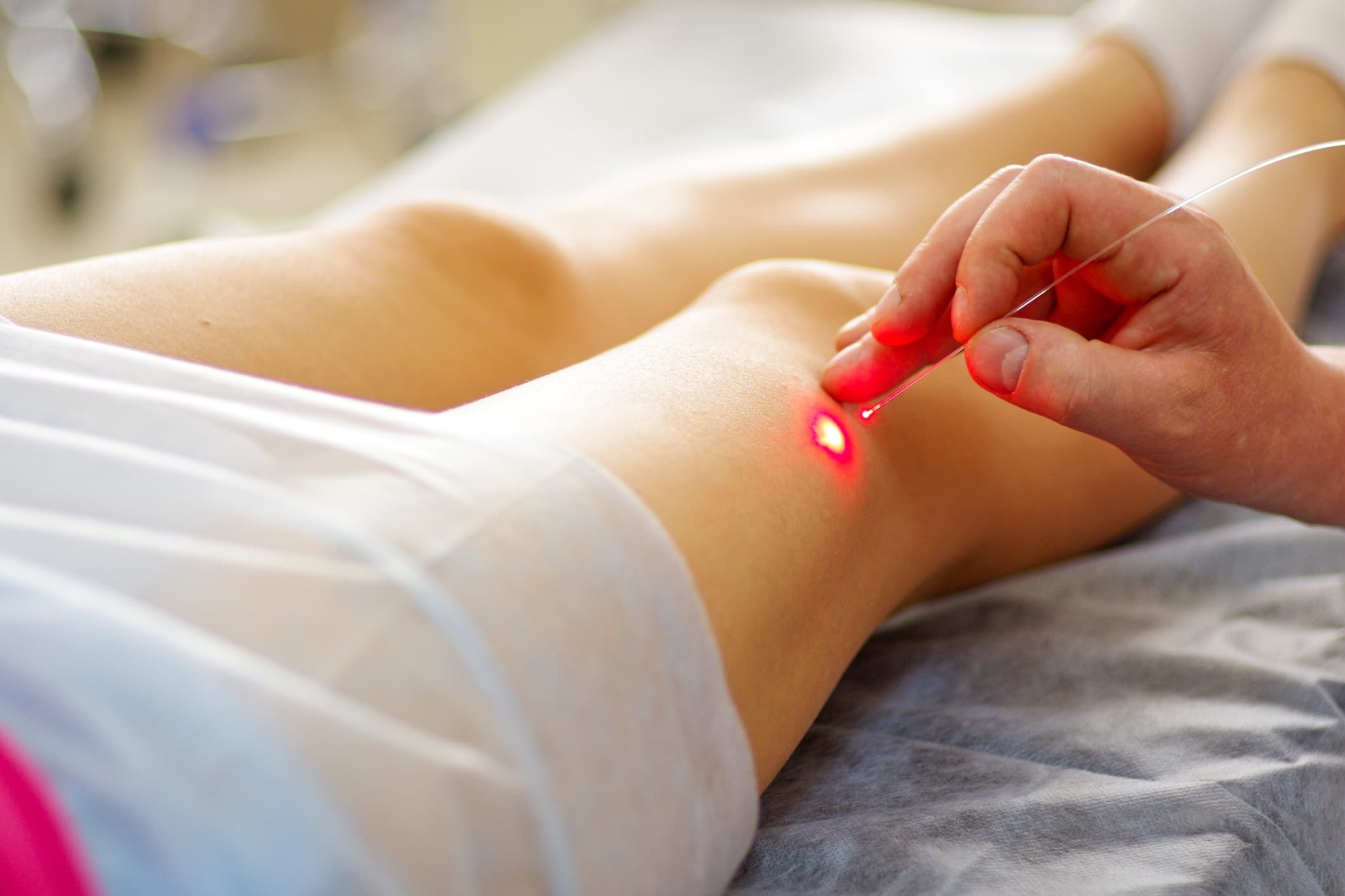 What to Expect at Your Very First Varicose Vein Consultation