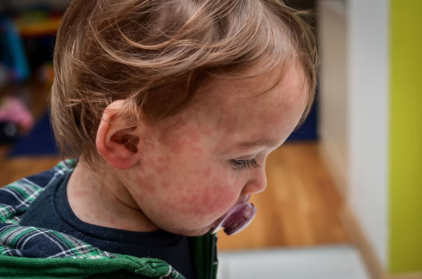 PAHO urges travelers in the Americas to boost protection against yellow fever and measles