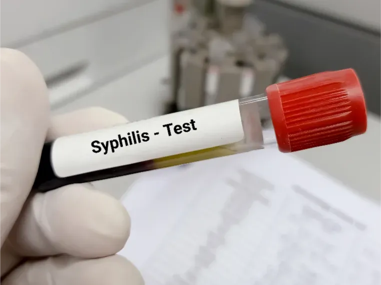 Barbados reports increase in syphilis cases, health officials urge testing and prevention