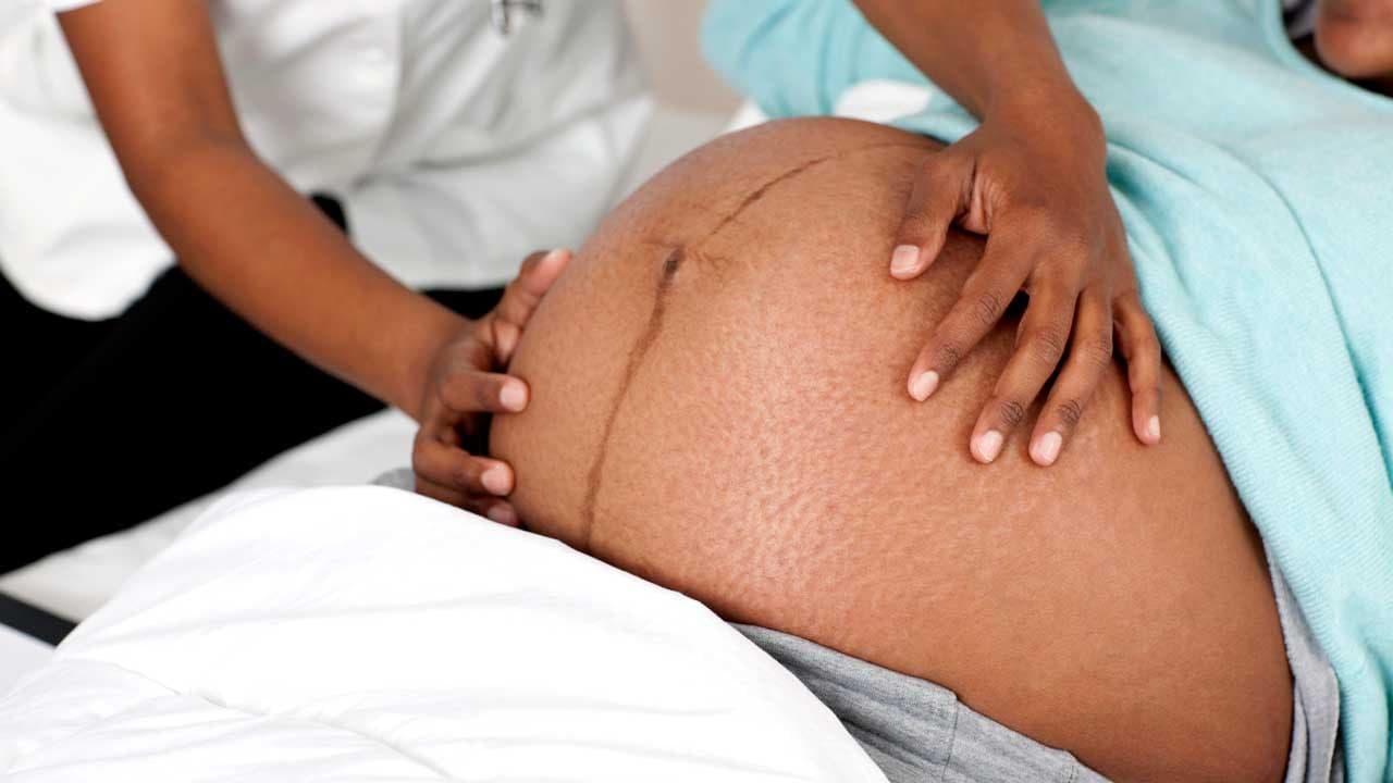 CDC study estimates 20-fold increase in Zika birth defects