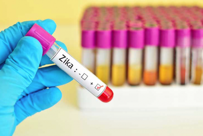 testing-for-zika-in-broward