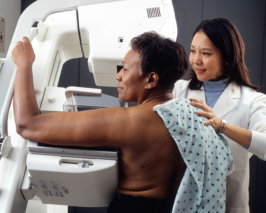 Breast most cancers prevention: Daring and proactive practices for Caribbean girls