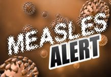 Belize confirms measles case linked to Guatemala travel measles