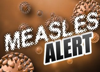 Belize confirms measles case linked to Guatemala travel measles