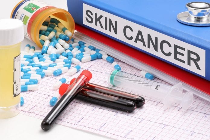 Skin Cancer Awareness Month calls attention to importance of annual skin checks