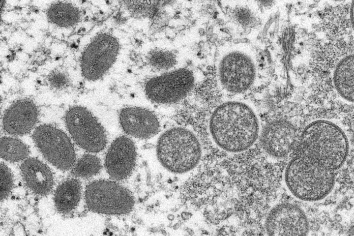 WHO declares mpox no longer a global health emergency