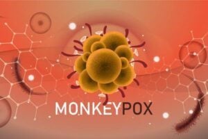 Guyana Monkeypox patients may have contracted virus through personal, sexual contact