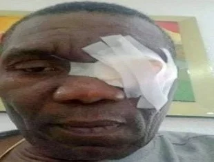 Haiti Senate President Joseph Lambert injured during attack