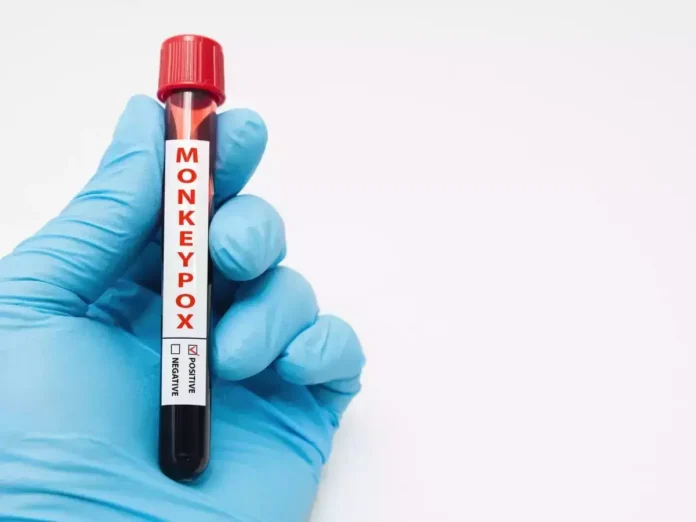 Monkeypox virus