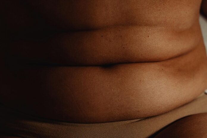 obesity