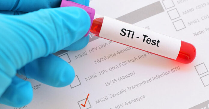 sexually transmitted infections Grenada