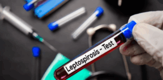 Jamaica health officials warn of spike in leptospirosis after Hurricane Melissa leptospirosis