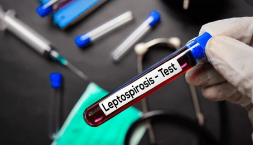 Jamaica declares leptospirosis outbreak with 6 deaths reported