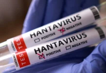 St . Kitts and Nevis national among cruise ship passengers linked to Hantavirus outbreak Hantavirus