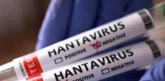 St . Kitts and Nevis national among cruise ship passengers linked to Hantavirus outbreak Hantavirus